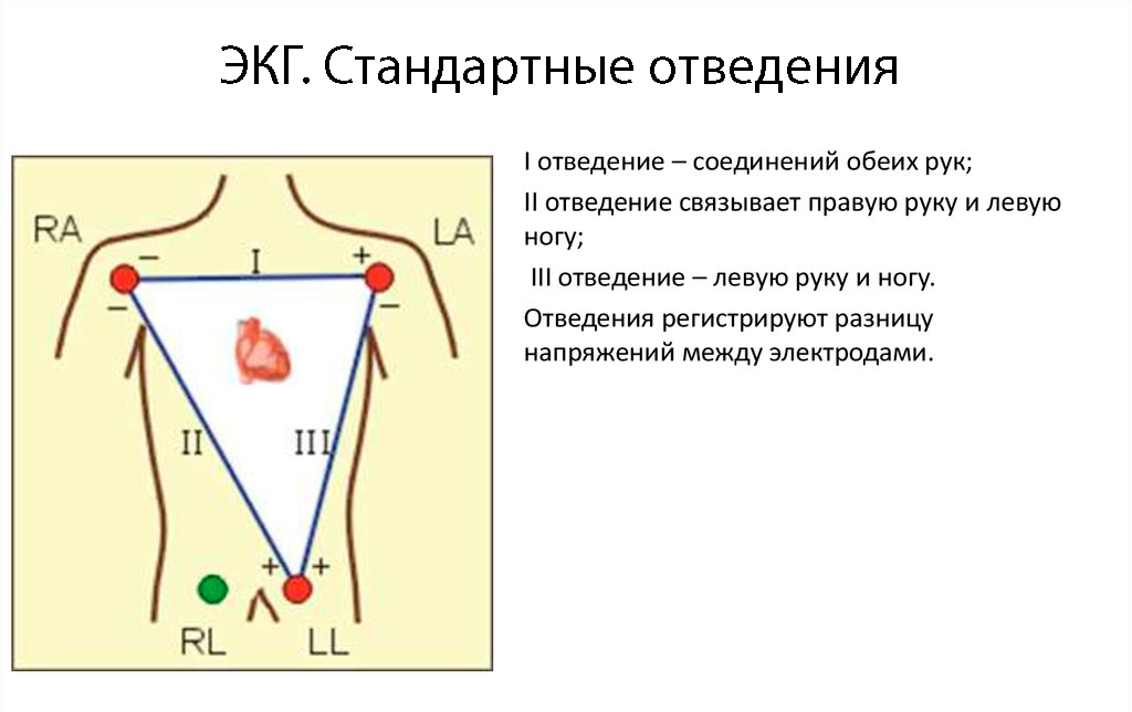 ЭКГ. Стандартные отведения.